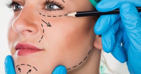 Блефаропластика – это молодость и красота