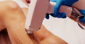 Как выбрать оптимальный метод лазерной эпиляции для разных типов кожи