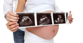 ЭКО в Москве