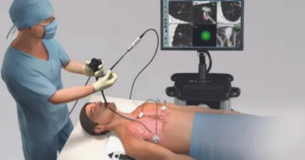 Как сделать бронхоскопию?