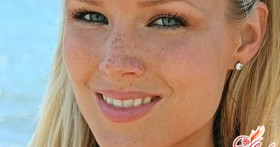 Пигментные пятна на коже – это не проблема!