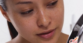 Пигментация на лице: лечение в домашних условиях