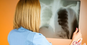 Туберкулез легких: как распознать, лечить и предотвратить?