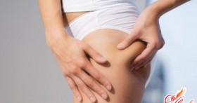 Как убрать растяжки на теле?