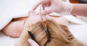Что из себя представляет мезотерапия для волос