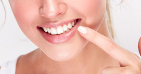 Профессиональные и домашние способы отбеливания зубов