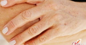 Пигментные пятна на руках – прочь!