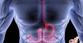 Причины и лечение варикозного расширения вен пищевода