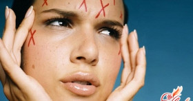 Лучшее средство от прыщей – для вас!