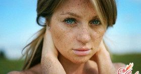 Пигментные пятна на теле. Причины появления и способы борьбы