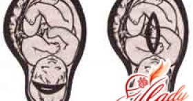 Сокращение матки после родов и во время беременности