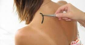 Пиявки для похудения: реальная помощь или вымысел?