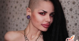 Самые большие губы в мире: красота или уродство?