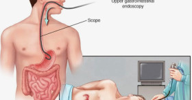 Важное о гастроскопии