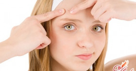 Избавление от акне на лбу