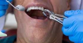 Всегда ли требуется удаление зуба мудрости?