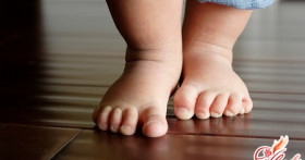 Плоско-вальгусная деформация стоп ребенка: причины, лечение, профилактика