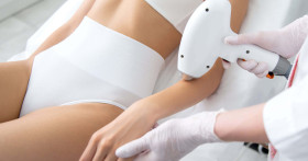 Лазеры для удаления волос