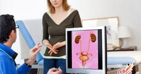 Какие существуют упражнения для укрепления мышц мочевого пузыря