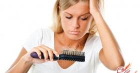 Причины облысения у женщин и способы его лечения