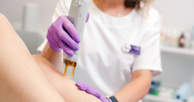 В чем преимущества лазерной эпиляции александритовым лазером