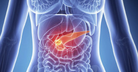 Причины и симптомы воспаления поджелудочной железы