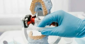 Сплинт-терапия в стоматологической клинике: эффективное решение проблем ВНЧС