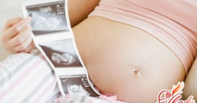 Тазовое предлежание плода