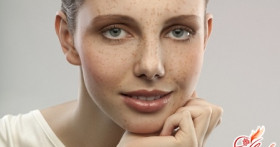 Как избавиться от пигментации на лице при помощи пилинга