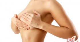 Симптомы и лечение внутрипротоковой папилломы