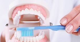 Пародонтологическая чистка зубов