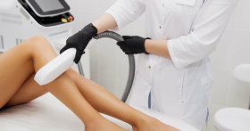 Аппарат для лазерной эпиляции: ключ к гладкой коже и успешному бизнесу