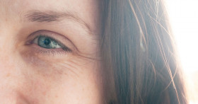 Откуда берутся мимические морщины и как вернуть себе молодость