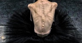 Как заболеть анорексией и чем это грозит в будущем