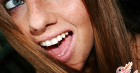 Как удалить пигментные пятна на лице в домашних условиях?