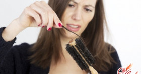 Методы лечения андрогенной алопеции