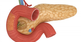 Как протекает геморрагический панкреонекроз?