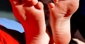 Синдром усталых ног