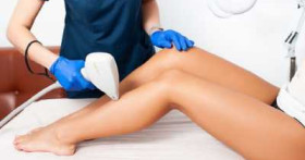 Всё, что нужно знать про лазерную эпиляцию