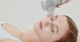 SMAS-лифтинг Ultraformer: эффективная процедура для омоложения