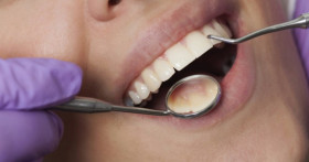 Лечение периодонтита и гигиеническая чистка зубов: современные методы сохранения здоровья полости рта