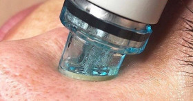 Что такое гидропилинг Hydrafacial и как он влияет на кожу