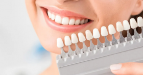 Эстетическая стоматология: основные процедуры