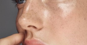 Что делать, если кожа на лице шелушится?