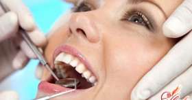 Профессиональная гигиена ротовой полости