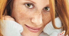 Пигментные пятна на лице: причины появления и методы избавления