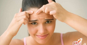 Подростковые прыщи. Избавляемся от них