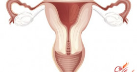 Варикоз матки: характерные симптомы и лечение
