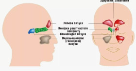 Клинические рекомендации при остром синусите