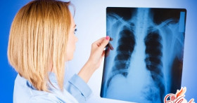 Как вылечить туберкулез легких народными средствами?